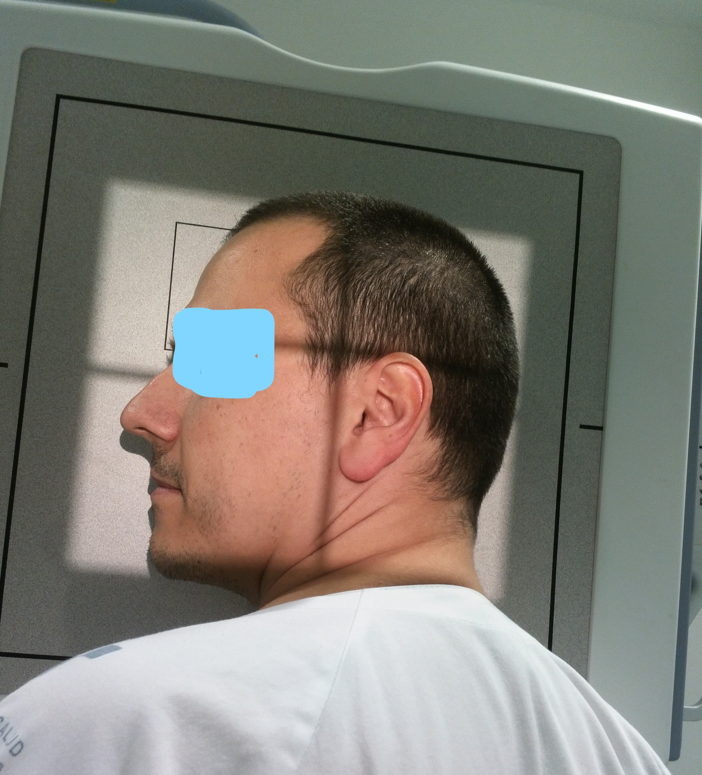 Lateral Skull Positioning